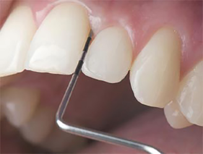 Краснодар лечение зубов расценки