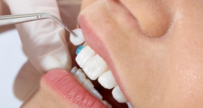 Стоимость лечения зуба краснодар