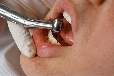 Краснодар лечение зубов расценки
