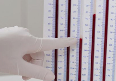Стоимость анализов крови в донецке