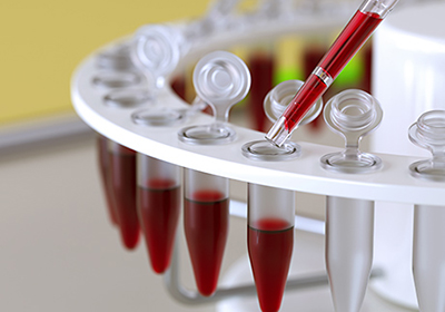 Анализ на биохимию крови донецк