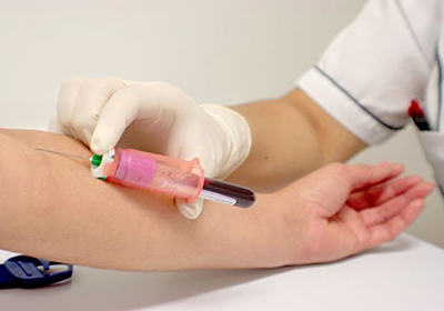 Сдать общий анализ крови в донецке