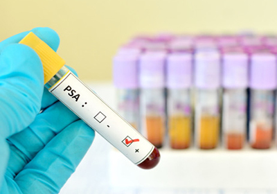 Анализ на гепатит цена новочеркасск